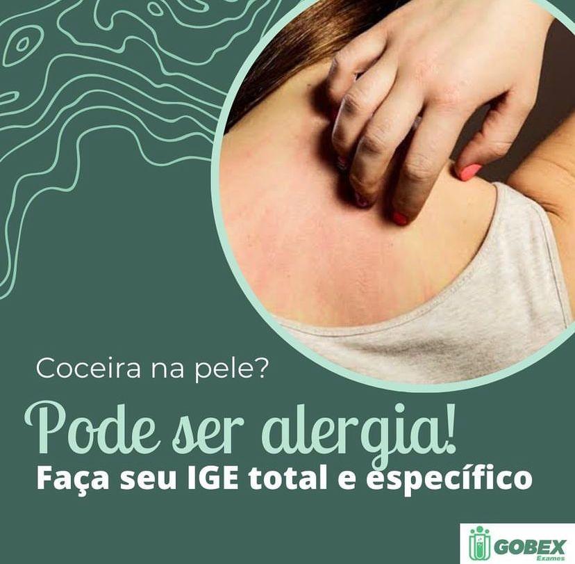 Coceira